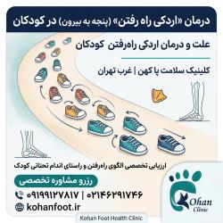 درمان «اردکی راه رفتن» (پنجه به بیرون) کودکان